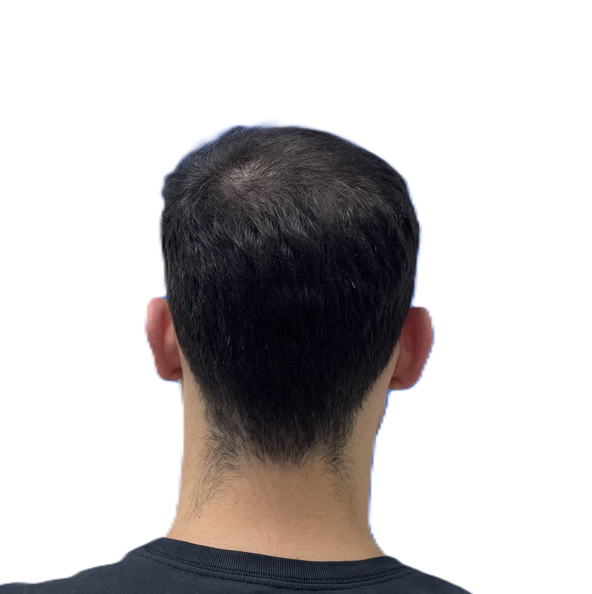 6 Meses Trasera Centrada