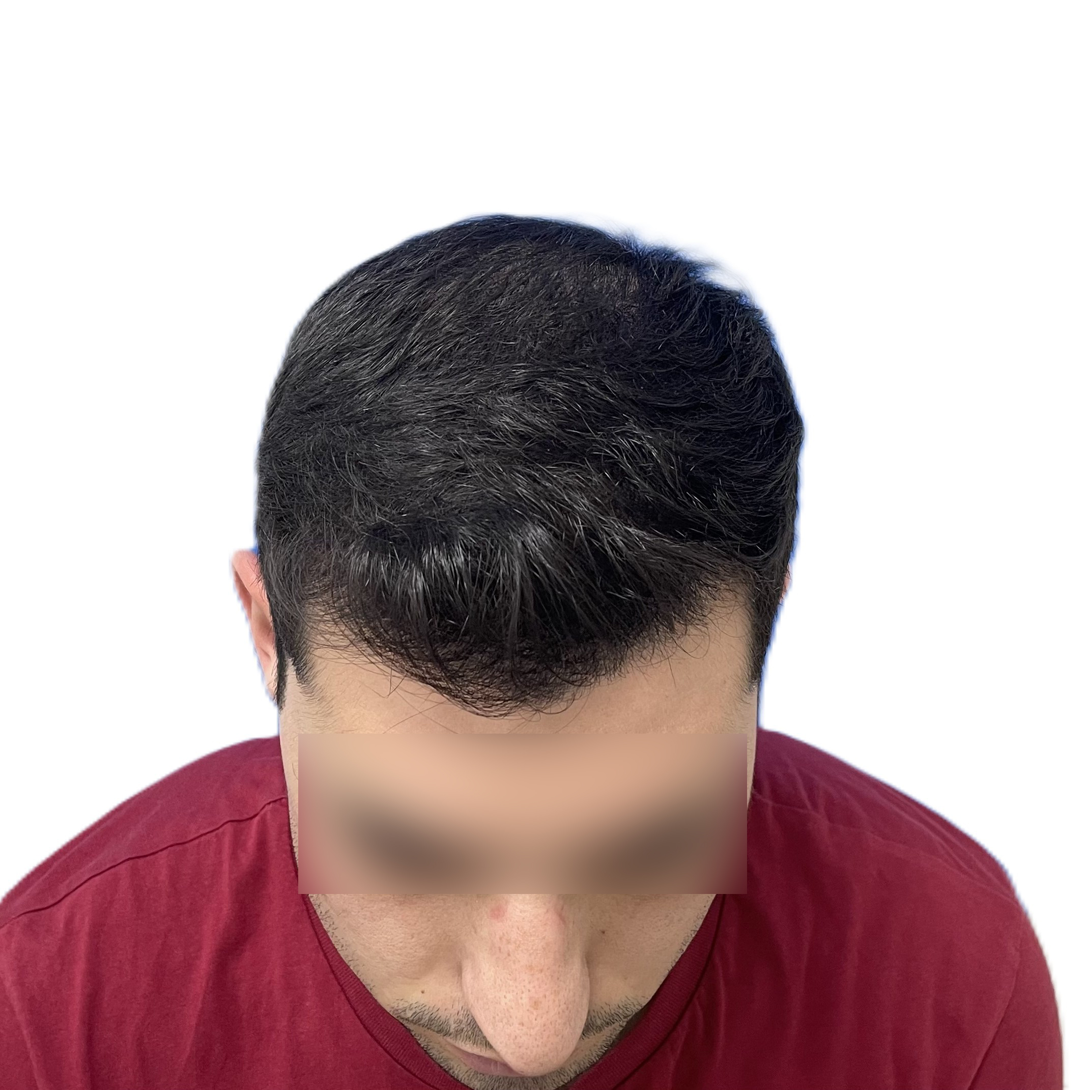 7 Meses Arriba Frontal