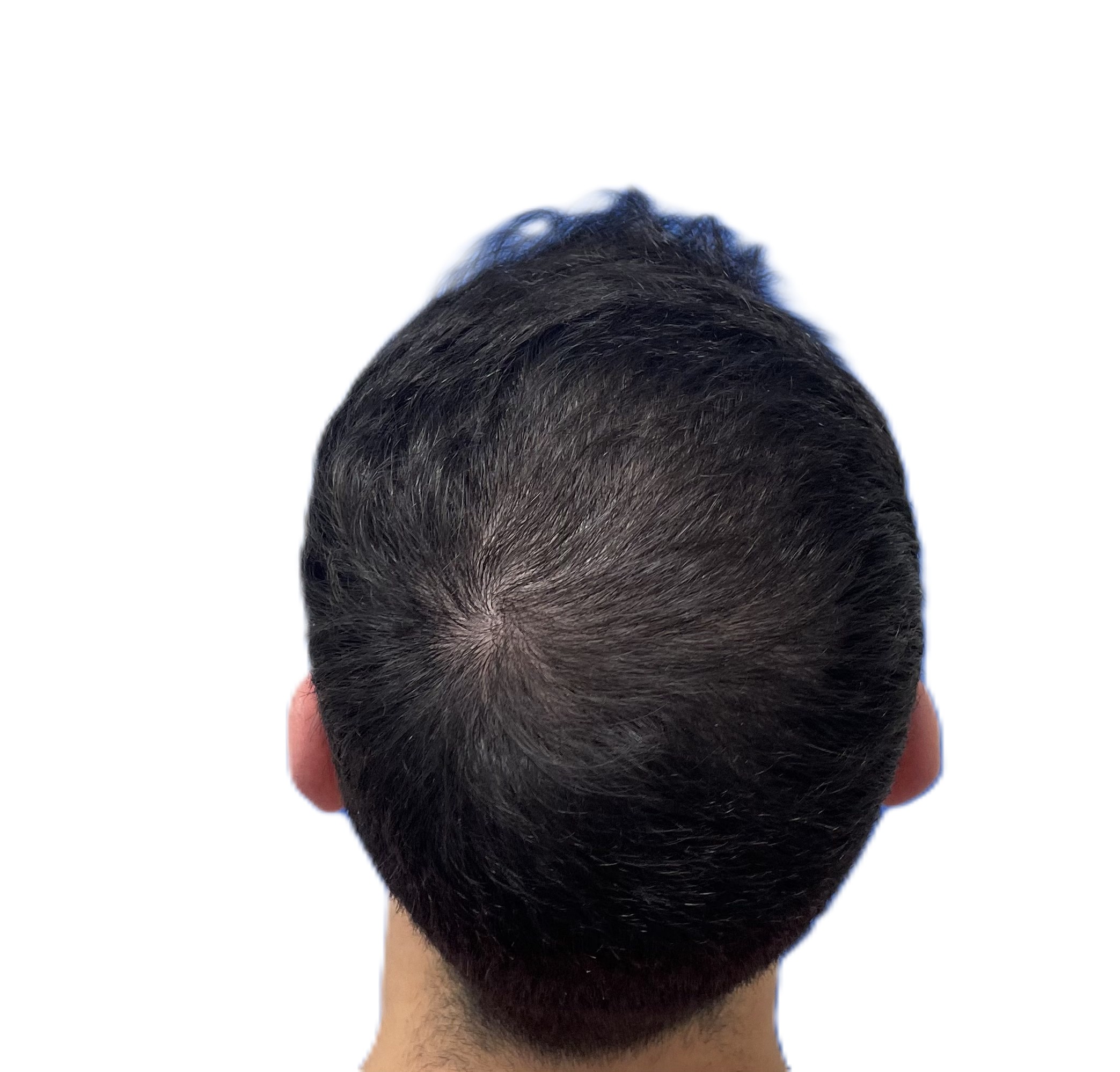 7 meses Trasera Arriba