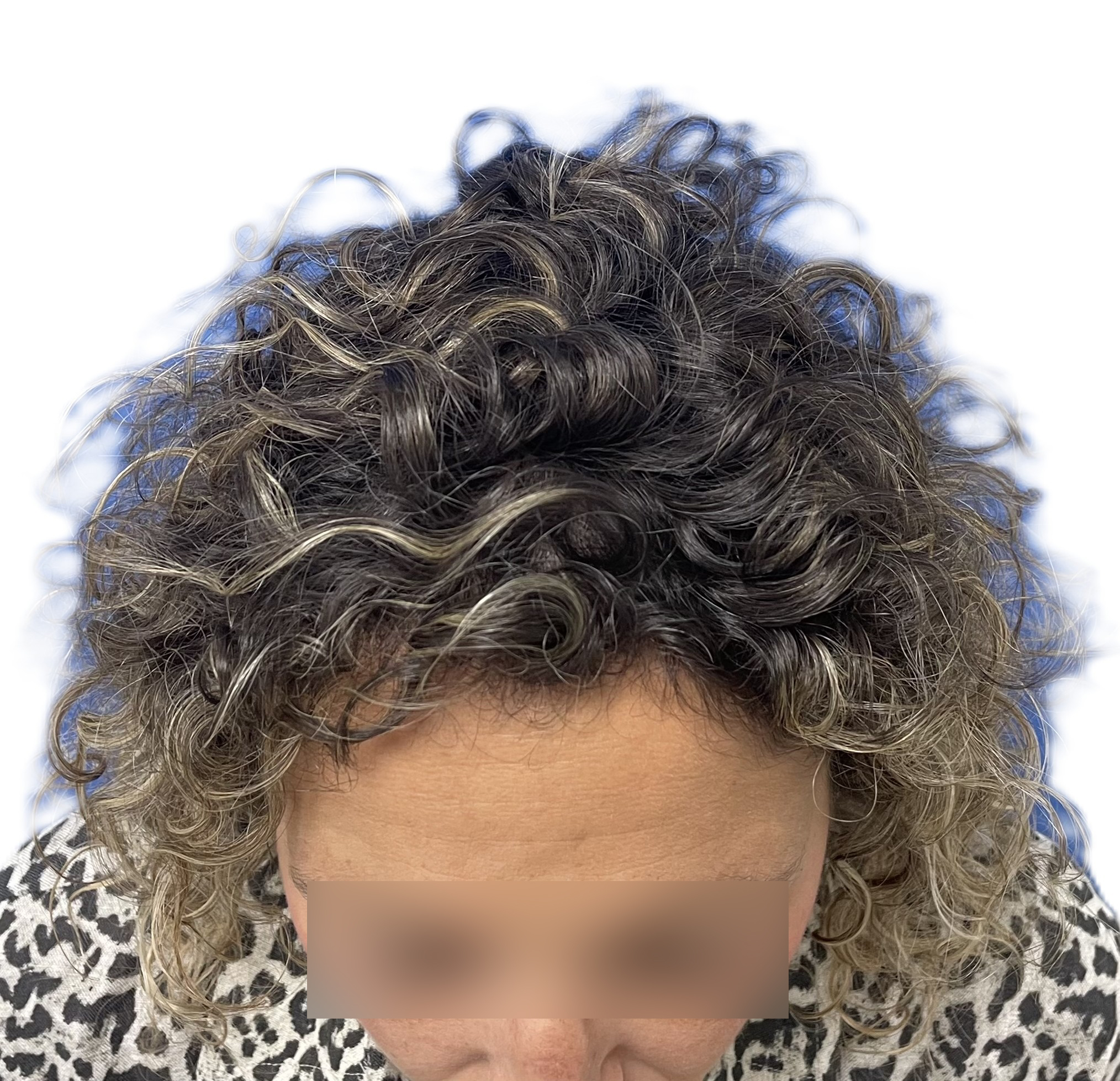 2 Meses Frontal Arriba