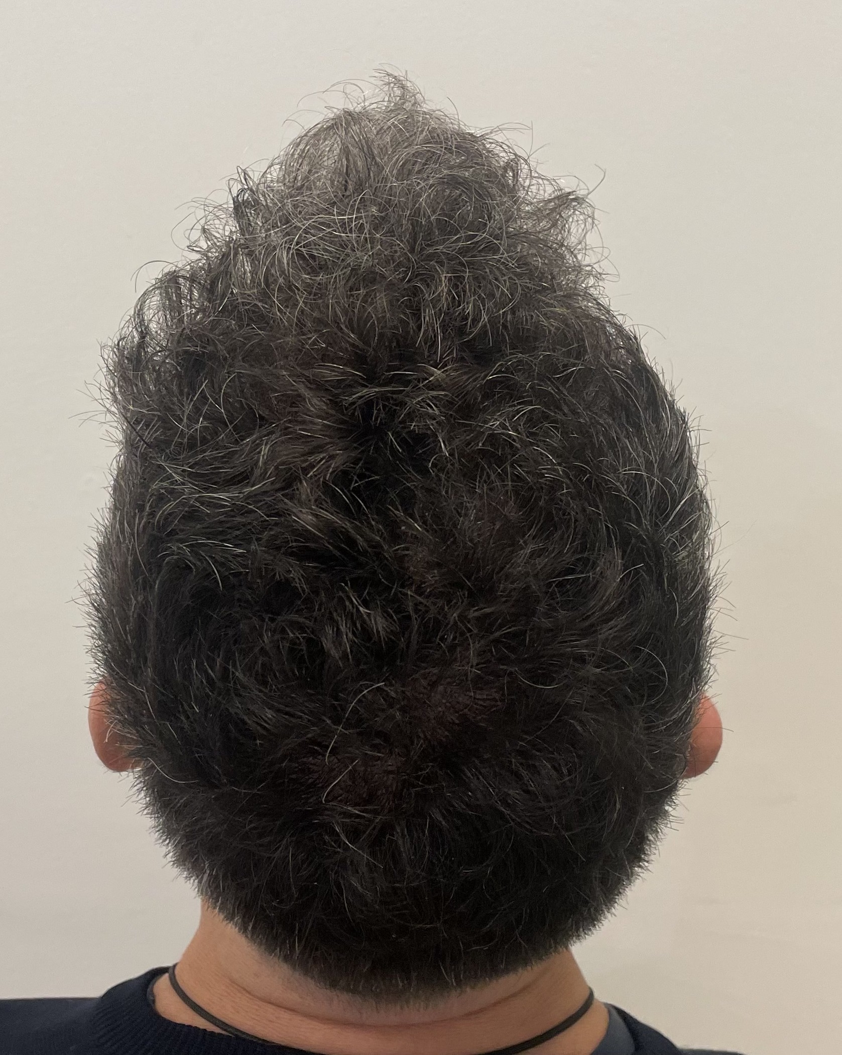 Antres Trasera Arriba