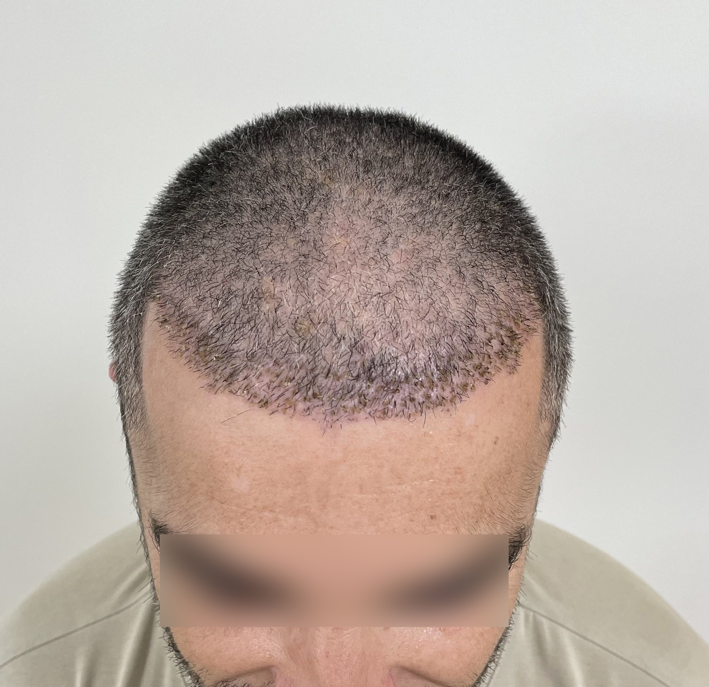 5 Meses Frontal Arriba